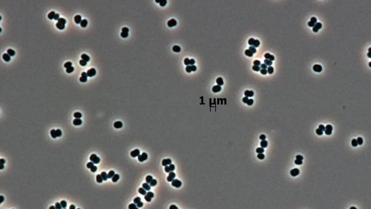 olu taklidi yapan super bakteriler uzayi bile tehdit ediyor kGuD1gU6.jpg