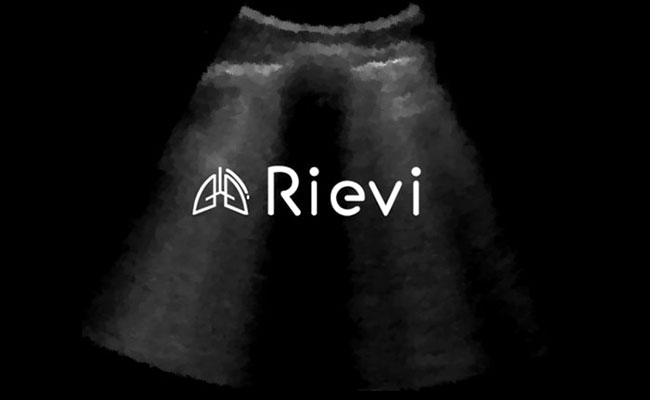 Akciğer Ultrasonu Tahlilinde Yapay Zeka